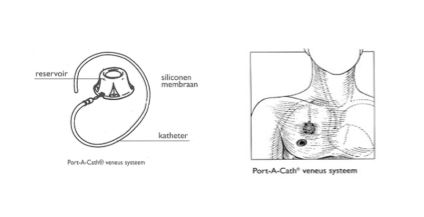 Afbeelding 2: fantoom